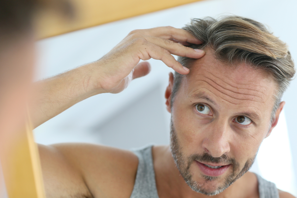 Alopecia: y | Kern Pharma